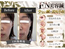 ケアラボ(Care Labo)