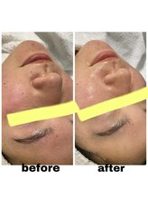 エクスクラメーションマーク(!!!)/韓国肌管理セット