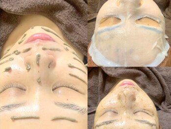 ボディメーキング リノ 調布店(Body making Lino)の写真/肌改善に有効的な成分を効率よく浸透させる最先端の美容法《VOSトリートメント》でくすみやハリツヤ改善へ!