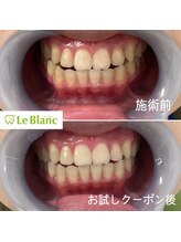 ルブラン 奈良店(Le Blanc)/お試し後、フリーパスへ切替！