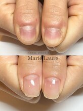 マリーロール 梅田店(Marie Laure)/自爪育成/深爪矯正/ネイルケア