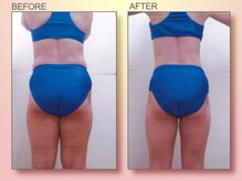 ジュリア オージェ 四条河原町店/ビフォーアフター（脂肪燃焼）