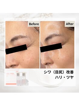 ルアナ(Luana)/ララピールの効果★