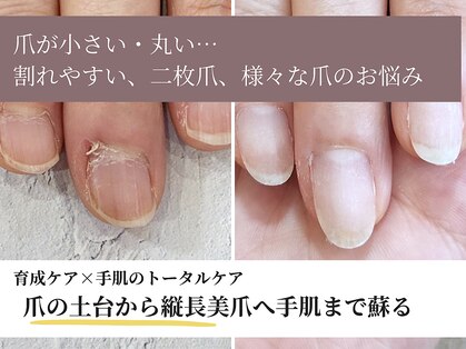 ウル(Uru)の写真