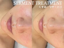 クレスト(CLEST.)/艶玉セルマントリートメント