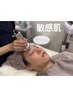 【敏感肌赤み】スタンダード肌質改善エステ+肌土台底上げ美容液導入¥12,800