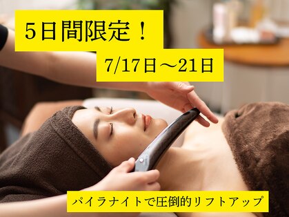 グレースフィオーレ 南越谷店(gracefiore)の写真