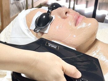 ニュアージュ(Nuage)の写真/気になるシミは数回で効果を実感!最新IPLで頑固なシミに徹底アプローチ★ノイズのない均一なお肌へ♪