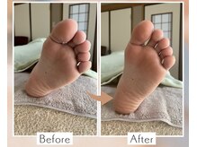 フウカ(Fuka)/足裏を整えて子宮や内臓も整う♪