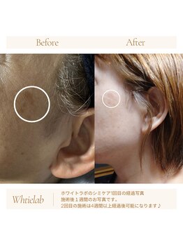 メイリー(Maylie)/WHITELABモニター/石巻メイリー