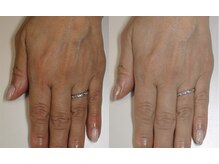 ベルティフィー(belltiffy)の雰囲気（素の手元に、プロの自信を。【2月末までモニター価格】）