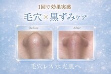 エステティック レイビス 渋谷店(RAYVIS)