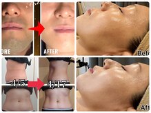 ファインボディ(Fine Body)