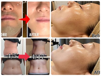 ファインボディ(Fine Body)の写真