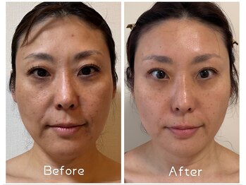 サロンドモモ(SALON de MOMO)の写真/くすみ・透明感が気になる方へ｜美肌ケア