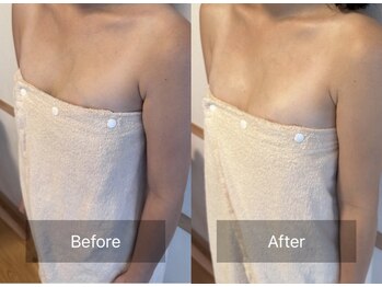 天使の艶肌 武蔵小杉店/バストアップ before/after2