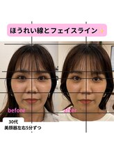 ベルソー鍼灸整体院(berceau鍼灸整体院)/