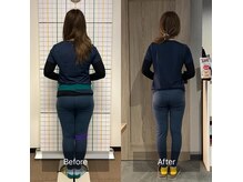 美容整体サロン プライム(Prime)の雰囲気（院長限定のダイエットコースは毎月3名のみ募集を行ってます。）