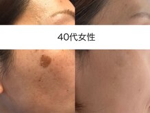 サクラ 本厚木駅前店(SAKURA)/本厚木シミケア/伊勢店シミケア