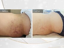 カド 白金台(Kado)/高評価◆DTケア/インディバ