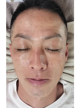 ベルカルポ(Bel Carp)の写真/髭、脇、VIO男の三大部位をプロが徹底して美を追求。男の身だしなみ、結果に特化した脱毛です◎