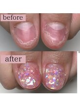 ティアラネイル 宇都宮/