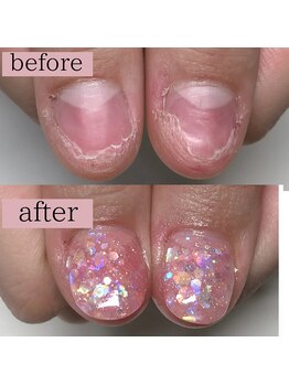 ティアラネイル 宇都宮/