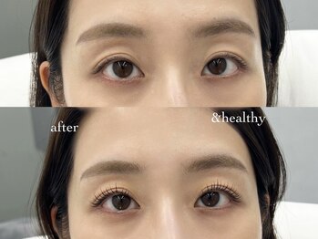 ディプティ モイラ(dipty MOILA)/アンドヘルシー