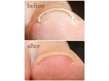 オリネイル 西荻窪(OriNail)の雰囲気（韓国発！特許取得の最新巻き爪ケアも導入◎ [荻窪/西荻窪]）