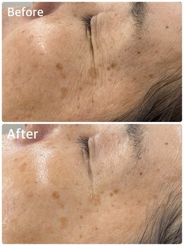 スハダビ110(suhadabi110)/before after