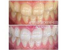 ホワイトニングルーム 川崎店(WhiteningRoom)/ホワイトニング/川崎