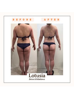 ルトゥーシア(Lotusia)/全身　before→after