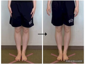 ソリ(soli)/before→after写真