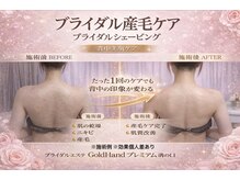 ゴールドハンド 溝の口店(Gold Hand)の雰囲気（当日肌状態チェック，トラブル肌状態施術も1回結果出し満足度1位）