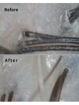 ストリクス(STRIX)/Before/After 【ヘッドスパ】