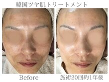 いごこちいい場所 ほのほの/40代からの！本気の肌改善！