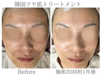 いごこちいい場所 ほのほの/40代からの！本気の肌改善！