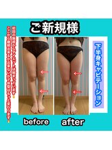 ビューティ ウィッチ(Beauty Witch)/