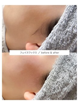 ウヅ(uzu)/つる肌フェイスワックス