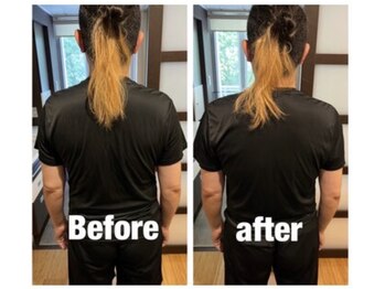 トトノウ 自由が丘店(totonou)/Before after (10)