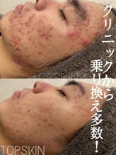 トップスキン 栄(TOPSKIN) 一生モノの 肌を創る