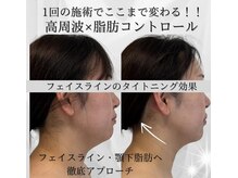 サロン ド ナース ユー ソナ(salon de nurse U.sona)