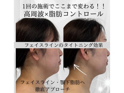 サロン ド ナース ユー ソナ(salon de nurse U.sona)の写真