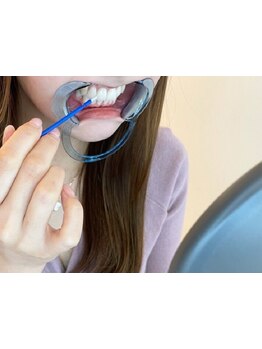 美白ケアをしたい