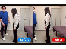 楽笑整体院の雰囲気（猫背やO脚など姿勢改善はお任せ！）