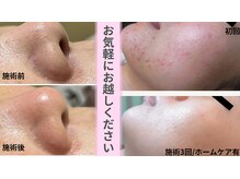 フェイシャル専門店　Bettyの雰囲気（毛穴悩みやニキビ悩み、乾燥肌や脂性肌悩みに根本アプローチ）