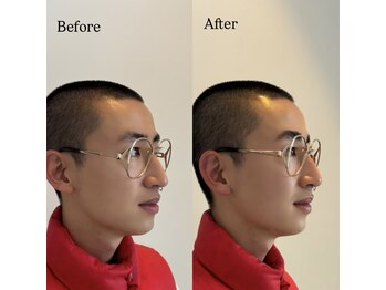 バレベッカ(Ballebecca)/HBL☆