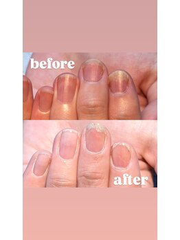 エンビー 下北沢(em.b)/爪を育てながらネイルを楽しむ