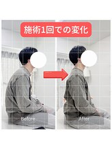 整体 寿 横浜院(KOTOBUKI)/横浜/横浜市/整体/肩こり