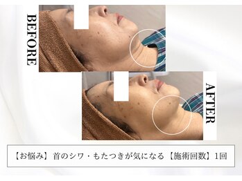 リリー 一宮店(Lily)/IT LIFT【60代】